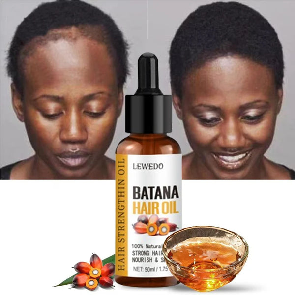 LEWEDO Naturals Pure Batana Oil - Fast Hair Growth, Anti-Hair Loss & Nourishing