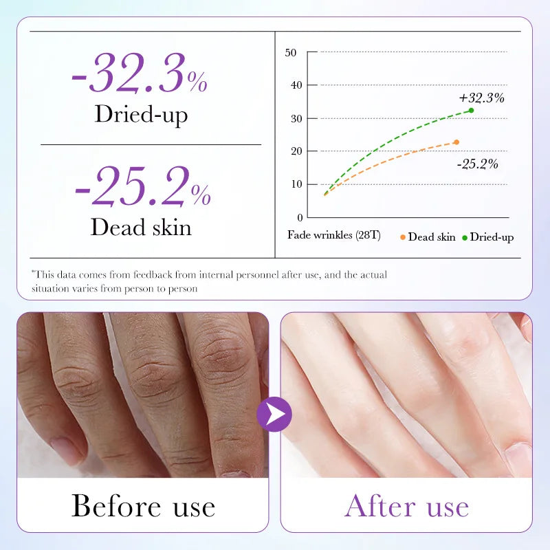 5-Pack Lavender Spa Hand Mask Gloves - Exfoliating, Whitening & Moisturizing