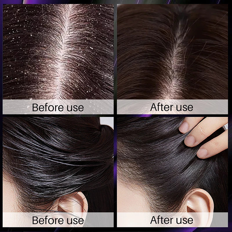 Eelhoe Rosemary & Onion Hair Growth Thickening Shampoo - Deep Cleansing Volumizing