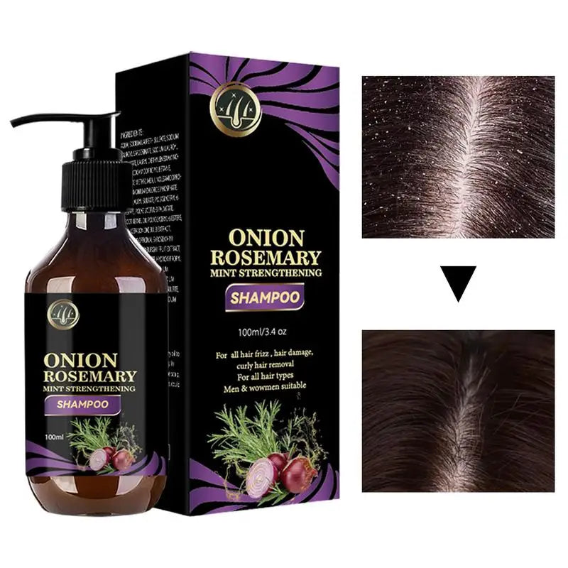 Eelhoe Rosemary & Onion Hair Growth Thickening Shampoo - Deep Cleansing Volumizing