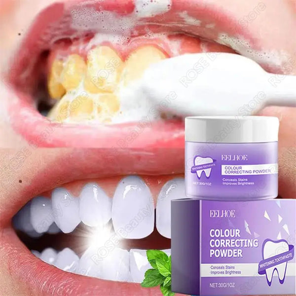 5-Day Teeth Whitening Powder - Removes Plaque, Stains & Calculus for Fresh Breath