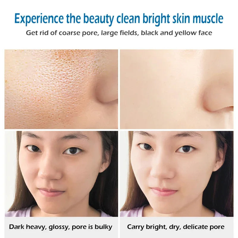 Sea Salt Whitening & Moisturizing Soap - Pore Cleansing, Acne & Pimple Treatment Bar