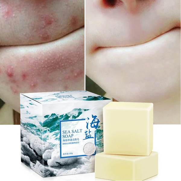 Sea Salt Whitening & Moisturizing Soap - Pore Cleansing, Acne & Pimple Treatment Bar