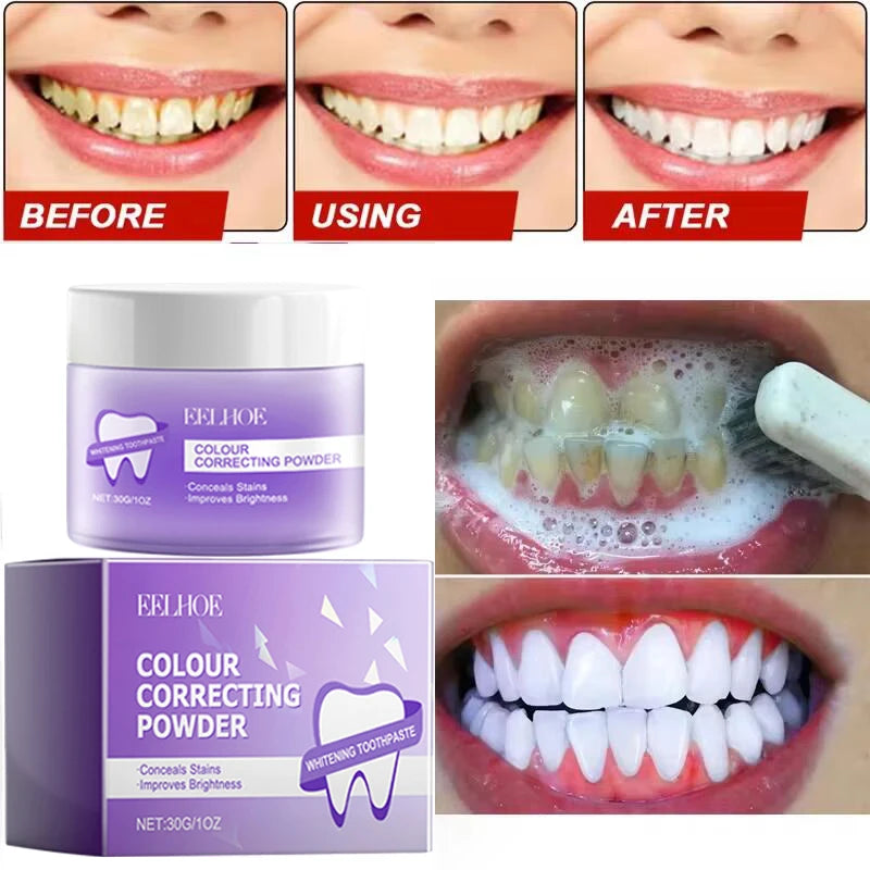 5-Day Teeth Whitening Powder - Removes Plaque, Stains & Calculus for Fresh Breath