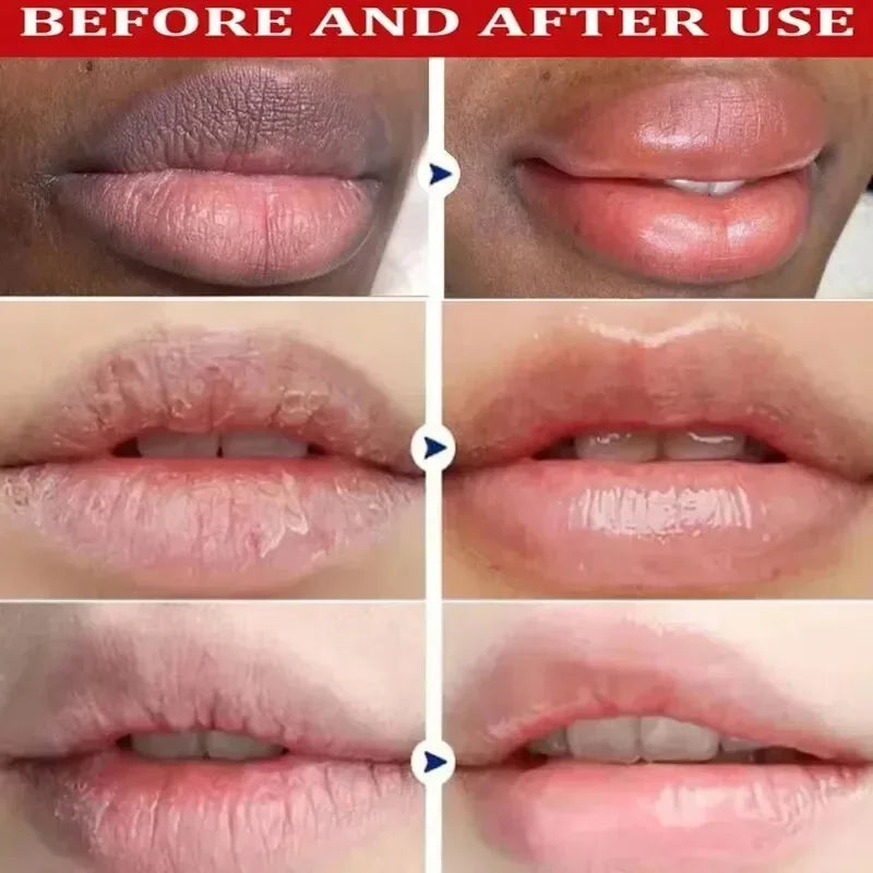 Dark Lip Lightening Balm & Melanin Mask - Exfoliating Pink Treatment for Lip Lines